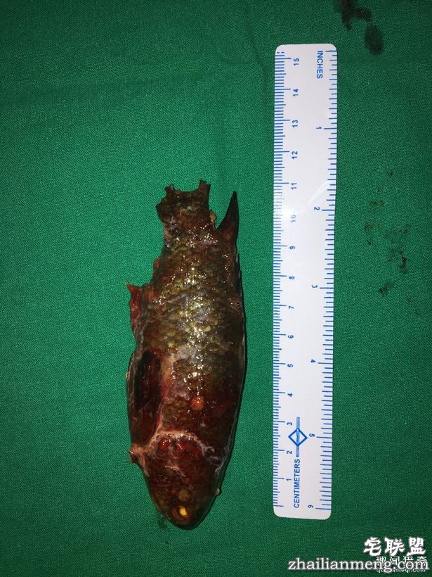 男子「活鱼卡喉咙」痛苦快死,医生「拉出整条画面」大傻眼!