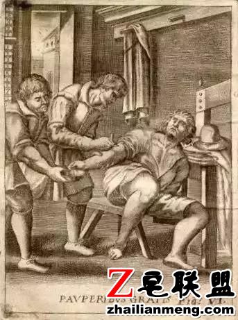 西方外科黑历史,理发师垄断手术只会放血,医生掘墓解剖练手速