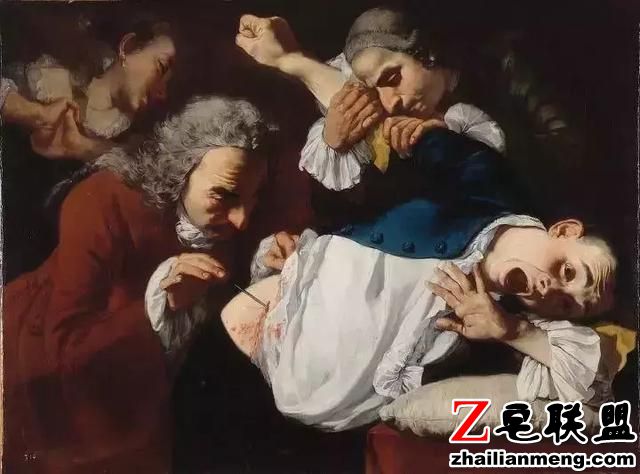 西方外科黑历史,理发师垄断手术只会放血,医生掘墓解剖练手速