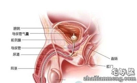 慢性前列腺炎的危害主要有哪些呢 患了前列腺炎怎么办